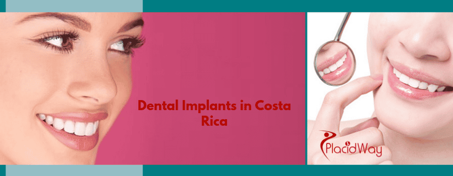3 on 6 dental implants costa rica
